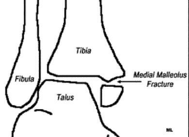 Ankle Anatomy Bones Structures
