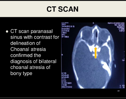 Computed tomography scans