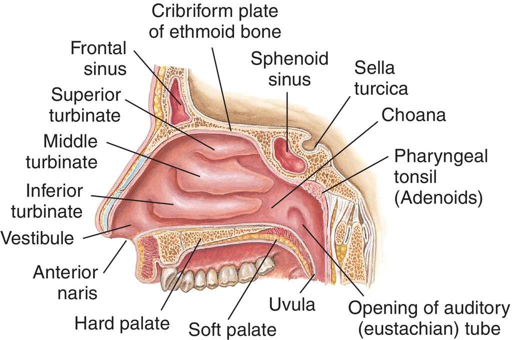 Choanal Atresia of nose