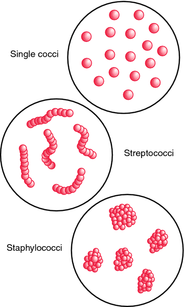 Occurrence of pathogenic coccus