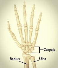 Wrist Pain Picture 2