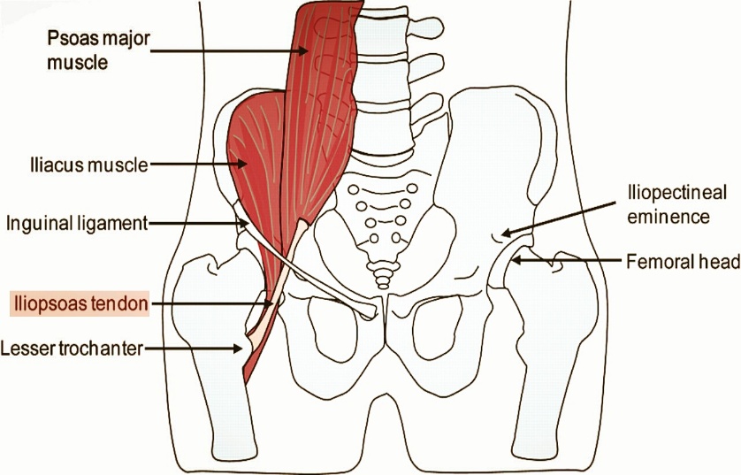 Hip Pain Picture 1