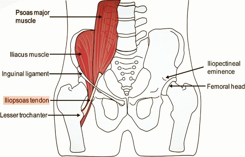 Hip Pain Picture 1