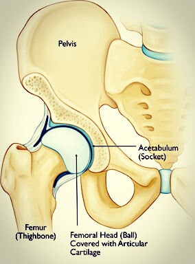 Hip Pain Picture 2
