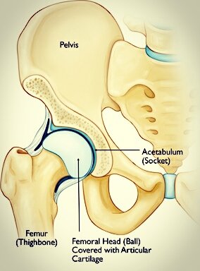 Hip Pain Picture 2