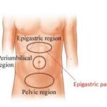 Epigastric Pain