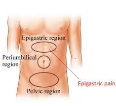 Epigastric Pain