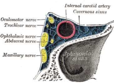 Cavernous sinus location related to cranial nerves