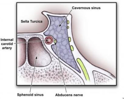 cavernous sinus location