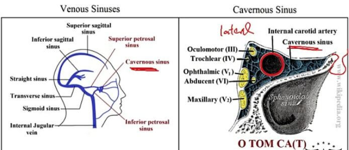 cavernous sinus images