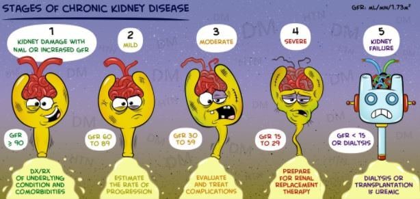 Stages of Chronic Kidney Disease