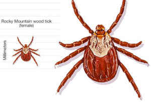 rocky mountain spotted fever tick