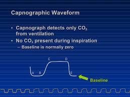 Capnography