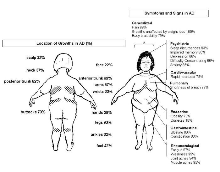 Dercum's Disease Symptoms