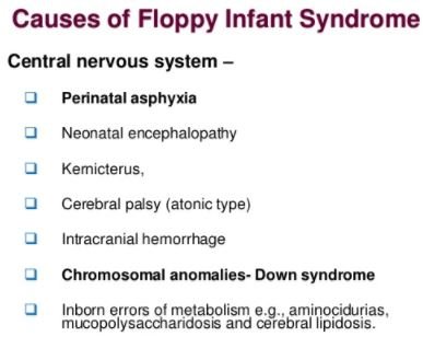 Floppy Baby Syndrome Causes