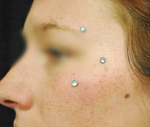 Dermal Piercing head