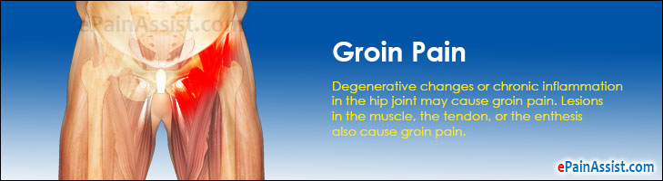 groin-pain-what-is-symptoms-causes-treatment-in-men-women