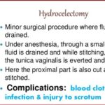Hydrocelectomy