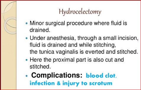 Hydrocelectomy-Picture-2