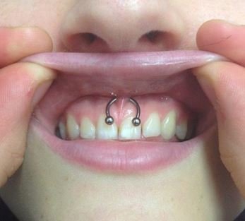 Smiley Piercing